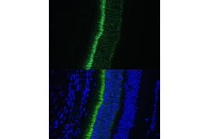 Immunofluorescence analysis of mouse eye using GNGT1 Polyclonal Antibody (ABIN7267288) at dilution of 1:100 (40x lens). (GNGT1 anticorps  (AA 1-45))