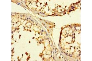 Immunohistochemistry of paraffin-embedded human testis tissue using ABIN7173639 at dilution of 1:100