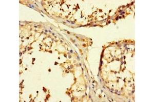 Immunohistochemistry of paraffin-embedded human testis tissue using ABIN7173639 at dilution of 1:100 (TULP3 anticorps  (AA 1-260))