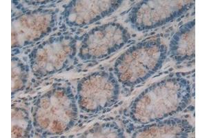 Detection of ITLN1 in Human Intestine Tissue using Polyclonal Antibody to Intelectin 1 (ITLN1)