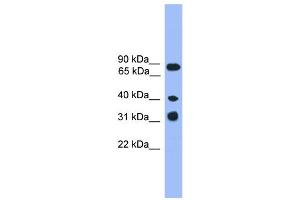 WB Suggested Anti-LAX1  Antibody Titration: 0. (LAX1 anticorps  (C-Term))