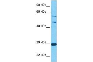 Host:  Rabbit  Target Name:  SPIC  Sample Tissue:  Human Jurkat Whole Cell  Antibody Dilution:  1ug/ml (SPIC anticorps  (C-Term))