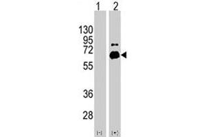 Western blot analysis of RPS6KB1 (arrow) using RPS6KB1 polyclonal antibody . (RPS6KB1 anticorps  (Ser424))