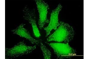 Immunofluorescence of monoclonal antibody to LMO3 on HeLa cell. (LMO3 anticorps  (AA 91-146))