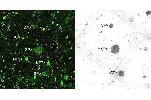 Immunohistochemical analysis of paraffin-embedded Alzheimer’s hippocampus using Thioflavin S (left panel) and ABIN1580412 using the HRP-DAB staining technique.