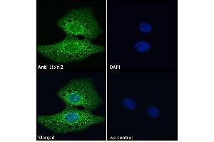 ABIN185361 Immunofluorescence analysis of paraformaldehyde fixed U2OS cells, permeabilized with 0. (Lipin 2 anticorps  (C-Term))