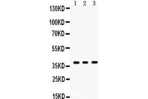 Anti- SIRT6Picoband antibody, Western blotting All lanes: Anti SIRT6  at 0. (SIRT6 anticorps  (AA 14-180))