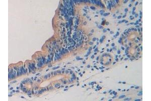 Detection of LAMb2 in Mouse Uterus Tissue using Polyclonal Antibody to Laminin Beta 2 (LAMb2)