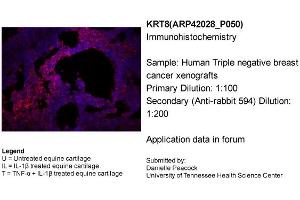 Sample Type: Human Triple Negative Breast Cancer XenograftsPrimary Dilution: 1:100Secondary (Anti-Rabbit 594) Dilution: 1:200
