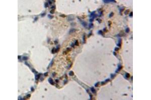 Used in DAB staining on fromalin fixed paraffin-embedded Lung tissue (Inhibitory Subunit of NF-KappaB zeta (AA 422-651) anticorps)