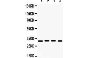 Western Blotting (WB) image for anti-Kv Channel Interacting Protein 2 (KCNIP2) (AA 78-112), (N-Term) antibody (ABIN3043273) (KCNIP2 anticorps  (N-Term))