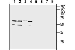 Western blot analysis of Malme-3 skin fibroblast cell line lysates (lanes 1 and 5), human  monocytic leukemia cell line lysate (lanes 2 and 6), human Jurkat T-cell leukemia cell line lysate (lanes 3 and 7) and human  retinal pigmental epithelia cell line lysate (lanes 4 and 8):1-4.