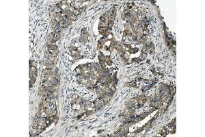 IHC analysis of MRP5/ABCC5 using anti-MRP5/ABCC5 antibody (ABIN7602224).