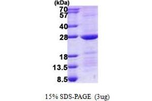 Image no. 1 for RAB10, Member RAS Oncogene Family (RAB10) (AA 1-200) protein (His tag) (ABIN1098775)