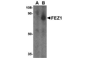 Western blot analysis of FEZ1 in SK-N-SH cell lysate with AP30333PU-N FEZ1 antibody at 1 μg/ml in the (A) presence and (B) absence of blocking peptide. (FEZ1 anticorps  (C-Term))