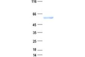 Validation with Western Blot
