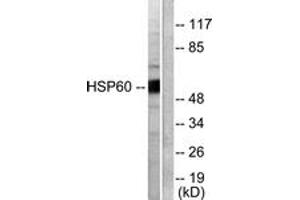 Western blot analysis of extracts from COLO205 cells, using HSP60 Antibody. (HSPD1 anticorps  (AA 511-560))