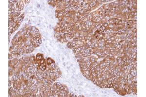 IHC-P Image Immunohistochemical analysis of paraffin-embedded DLD-1 xenograft , using MIPP , antibody at 1:500 dilution.