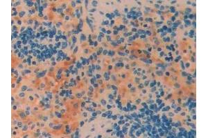 Detection of CRF in Rat Spleen Tissue using Polyclonal Antibody to Corticotropin Releasing Factor (CRF)