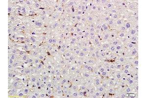 Formalin-fixed and paraffin embedded rat liver labeled with Rabbit Anti LIF Polyclonal Antibody, Unconjugated  at 1:200 followed by conjugation to the secondary antibody and DAB staining