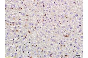 Formalin-fixed and paraffin embedded rat liver labeled with Rabbit Anti LIF Polyclonal Antibody, Unconjugated  at 1:200 followed by conjugation to the secondary antibody and DAB staining