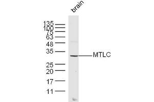 Mouse brain lysates probed with MTLC Polyclonal Antibody, unconjugated  at 1:300 overnight at 4°C followed by a conjugated secondary antibody at 1:10000 for 60 minutes at 37°C. (Myc Target 1 anticorps  (AA 21-100))