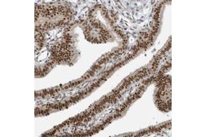 Immunohistochemical staining of human esophagus with YTHDC1 polyclonal antibody  shows strong cytoplasmic and nuclear positivity in squamous epithelial cells at 1:200-1:500 dilution. (YTHDC1 anticorps)