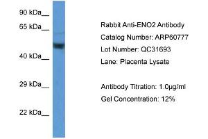 Western Blotting (WB) image for anti-Enolase 2 (Gamma, Neuronal) (ENO2) (Middle Region) antibody (ABIN2788574) (ENO2/NSE anticorps  (Middle Region))