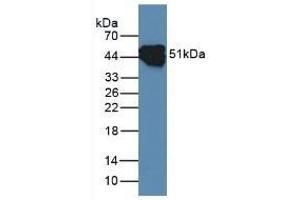 Detection of CK14 in Rat Skin Tissue using Polyclonal Antibody to Cytokeratin 14 (CK14)
