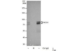 IP Image Immunoprecipitation of FACL4 protein from HeLa whole cell extracts using 5 μg of FACL4 antibody [C3], C-term, Western blot analysis was performed using FACL4 antibody [C3], C-term, EasyBlot anti-Rabbit IgG  was used as a secondary reagent. (ACSL4 anticorps  (C-Term))