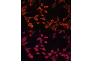 Immunofluorescence analysis of NIH/3T3 cells using SLC25 antibody (ABIN6132701, ABIN6147913, ABIN6147915 and ABIN6215984) at dilution of 1:100.