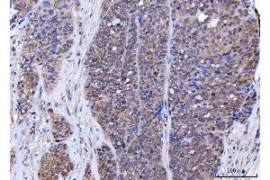 IHC analysis of BAT3/BAG6 using anti-BAT3/BAG6 antibody (ABIN6719601). (BAT3 anticorps)