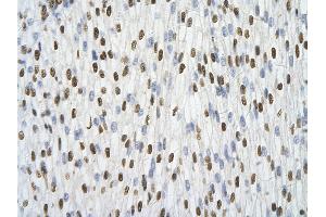 Rabbit Anti-HNRPA1 antibody   Paraffin Embedded Tissue: Human Heart cell Cellular Data: cardiac cell of renal tubule Antibody Concentration: 4.