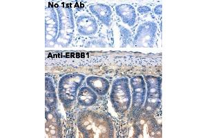 Immunohistochemistry (IHC) image for anti-Epidermal Growth Factor Receptor (EGFR) (C-Term) antibody (ABIN6254171) (EGFR anticorps  (C-Term))