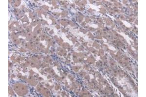 Detection of RARb in Human Stomach Tissue using Polyclonal Antibody to Retinoic Acid Receptor Beta (RARb)