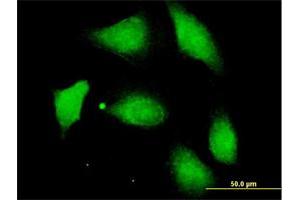 Immunofluorescence of purified MaxPab antibody to PPM1F on HeLa cell. (PPM1F anticorps  (AA 1-454))