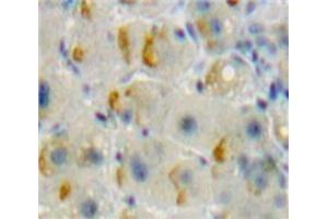 IHC-P analysis of Liver tissue, with DAB staining. (TNFRSF11A anticorps  (AA 359-542))