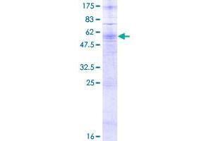 Image no. 1 for Purinergic Receptor P2Y, G-Protein Coupled, 10 (P2RY10) (AA 1-339) protein (GST tag) (ABIN1313819)