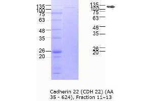 Western Blotting (WB) image for Cadherin-Like 22 (CDH22) (AA 35-624) protein (MBP tag) (ABIN3118965)
