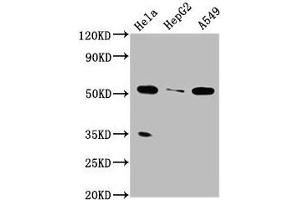Western Blot Positive WB detected in: Hela whole cell lysate, HepG2 whole cell lysate, A549 whole cell lysate All lanes: MSS51 antibody at 4 μg/mL Secondary Goat polyclonal to rabbit IgG at 1/50000 dilution Predicted band size: 52, 27, 11 kDa Observed band size: 52 kDa (ZMYND17 anticorps  (AA 258-365))