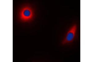 Immunofluorescent analysis of NDUFS1 staining in HeLa cells. (NDUFS1 anticorps  (C-Term))