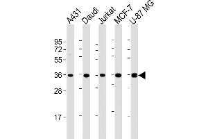 All lanes : Anti-MICA Antibody (Center) at 1:2000 dilution Lane 1: A431 whole cell lysate Lane 2: Daudi whole cell lysate Lane 3: Jurkat whole cell lysate Lane 4: MCF-7 whole cell lysate Lane 5: U-87 MG whole cell lysate Lysates/proteins at 20 μg per lane.