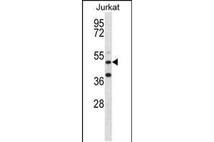 Western blot analysis in Jurkat cell line lysates (35ug/lane). (RBM22 anticorps  (AA 165-193))