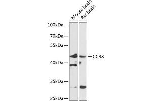Western blot analysis of extracts of various cell lines, using CCR8 antibody (ABIN6130010, ABIN6138101, ABIN6138102 and ABIN6224067) at 1:1000 dilution. (CCR8 anticorps  (AA 296-355))
