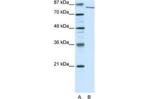 Western Blotting (WB) image for anti-Lysine (K)-Specific Demethylase 2A (KDM2A) antibody (ABIN2460277) (KDM2A anticorps)