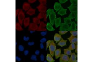 ABIN7096942 and ABIN7101008 staining Hela cells(30 min of UV treatment) by IF/ICC. (C22orf9 anticorps)
