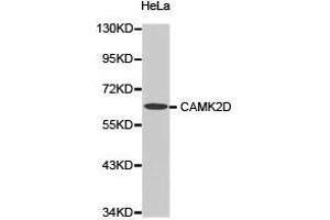 Western Blotting (WB) image for anti-Calcium/calmodulin-Dependent Protein Kinase II delta (CAMK2D) antibody (ABIN1871415) (CAMK2D anticorps)