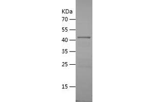 Western Blotting (WB) image for alpha-2-HS-Glycoprotein (AHSG) (AA 173-367) protein (His-IF2DI Tag) (ABIN7121798)