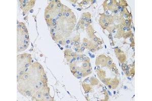 Immunohistochemistry of paraffin-embedded Human stomach using RPLP1 Polyclonal Antibody at dilution of 1:100 (40x lens). (RPLP1 anticorps)