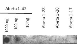 Western Blotting (WB) image for anti-Amyloid beta 1-42 (Abeta 1-42) antibody (ABIN334634) (Abeta 1-42 anticorps)
